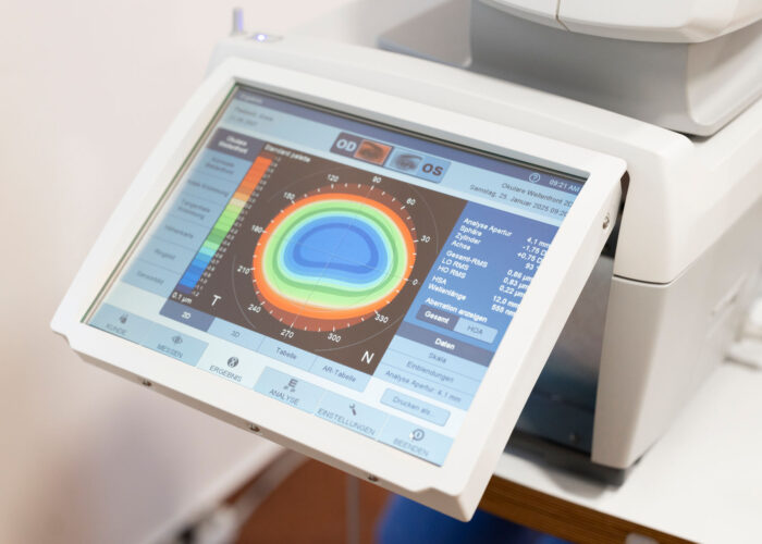 i.Profiler von ZEISS zur Ermittlung des individuellen Profils der Augen